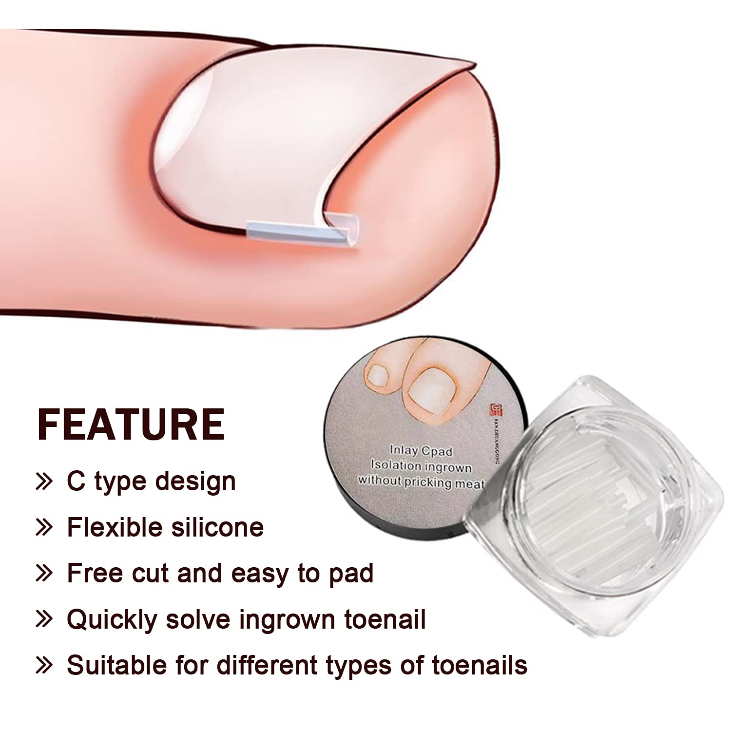Professional ingrown toenail Correction treatment Kit ( Pack of 10 )